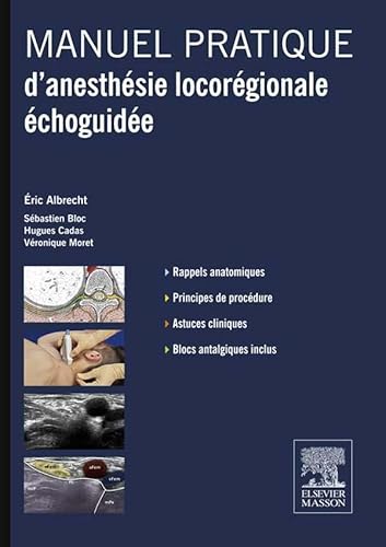 Manuel pratique d'anesthésie locorégionale