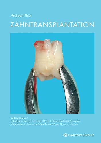 Zahntransplantation: Biologischer Zahnersatz für Kinder, Jugendliche und manche Erwachsene