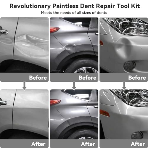 Diqdi 129PCS CAR DENT PULLER KIT 129Pcs Dent Puller Kit, Paintless Dent Repair Kit thumb #1