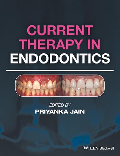 Current Therapy in Endodontics
