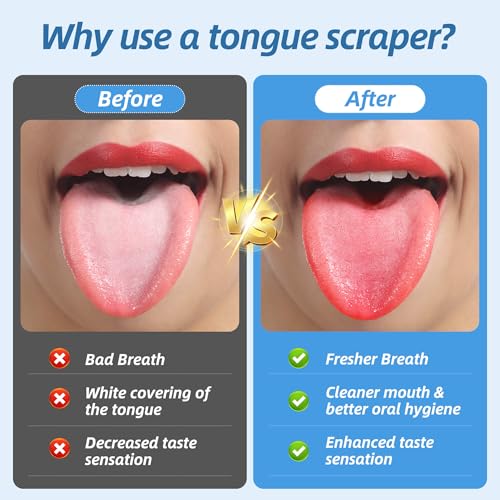 Aussumy 6 Pack Tongue Scraper - Reusable & Easy to Clean Tongue Scrubber with Travel Case for Adults & Kids - Medical-Grade 100% Stainless Steel Tongue Cleaner for Fresh Breath & Oral Care - Thumbnail 2