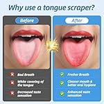 6 Pack Tongue Scrapers - Reusable & Easy to Clean Tongue Scrubber with Travel Case for Adults & Kids - Medical-Grade 100% Stainless Steel Tongue Cleaner for Fresh Breath & Oral Care - Image 2