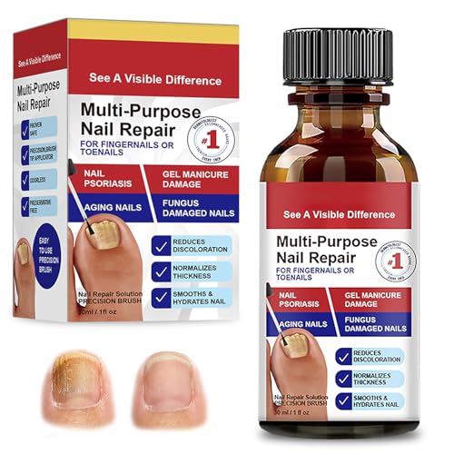 30ml Endurecedor y Reparador de Uñas, Reparadores de Uñas Solución, Cuidado uñas, Fortalece la estructura de la uña, Ayuda a Mejorar su Apariencia y Brillo Natural
