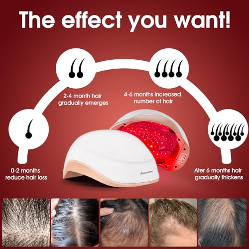 Touca de crescimento capilar a laser 180 lasers, tratamentos de queda de cabelo para homens e mulher