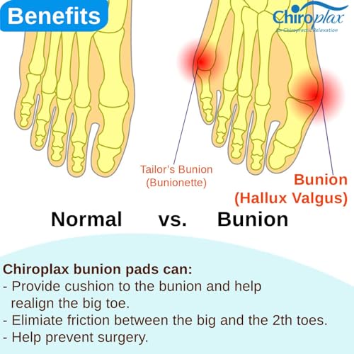 Chiroplax Bunion Corrector for Women & Men Relief Cushion Pads Hallux Valgus Guard Toe Separator Straightener Splint Protector Shield Spacer Sleeve Cover (4 Pads w/Shims, Medium) - Thumbnail 5