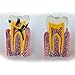 J&J Ortho Caries Cross-section Vertical View Dental Model