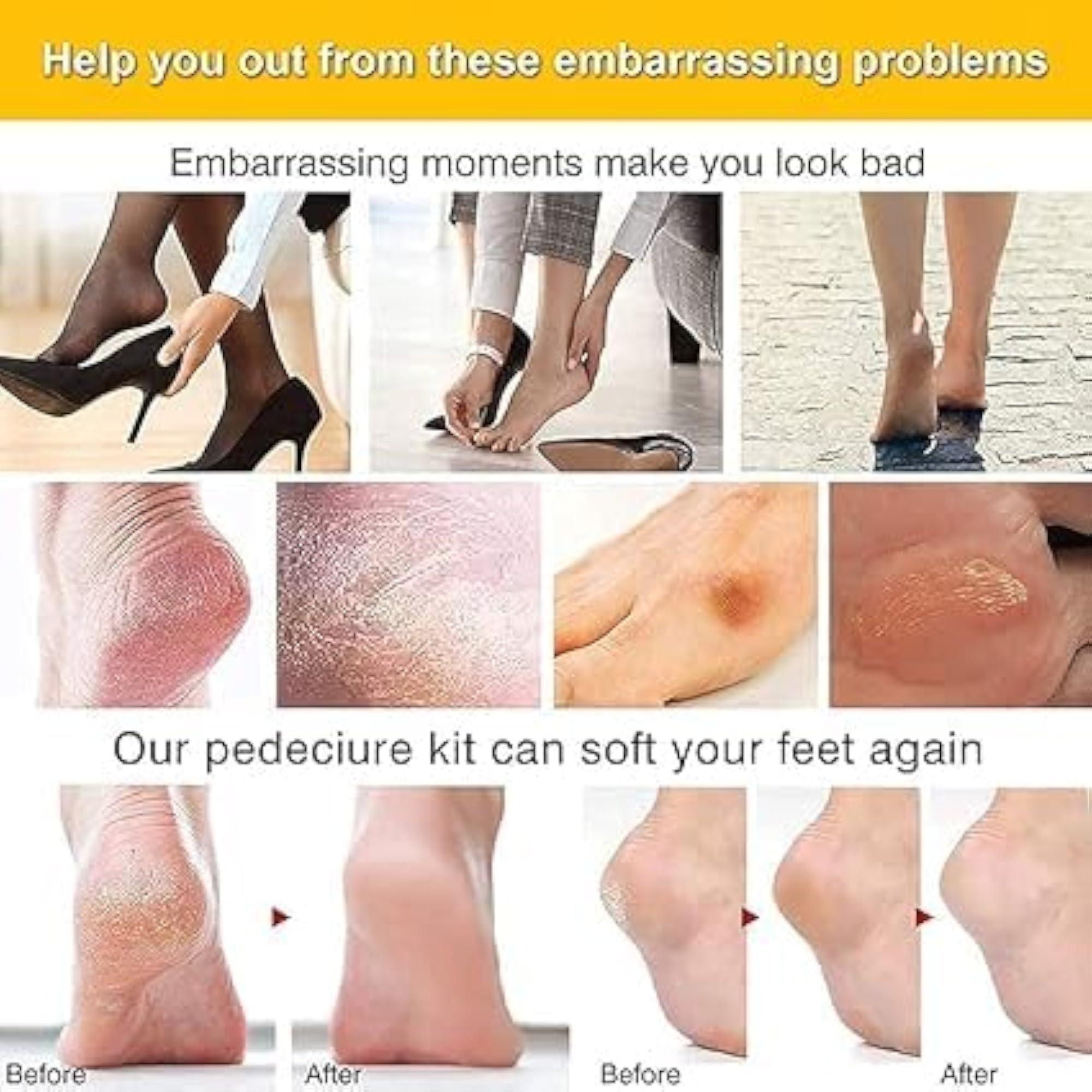 8 in 1 Pedicure Kit for Comprehensive Foot Care