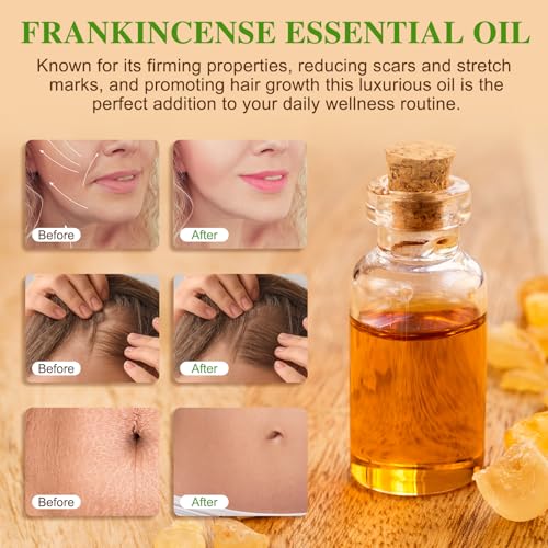 Weihrauchöl Bio für Haut – 100% Reines Ätherisches Frankincense Oil 60ml – Natürliche Hautpflege gegen Falten – Weihrauchöl für Gesicht, Körper & Aromatherapie – Feuchtigkeit für jeden Hauttyp