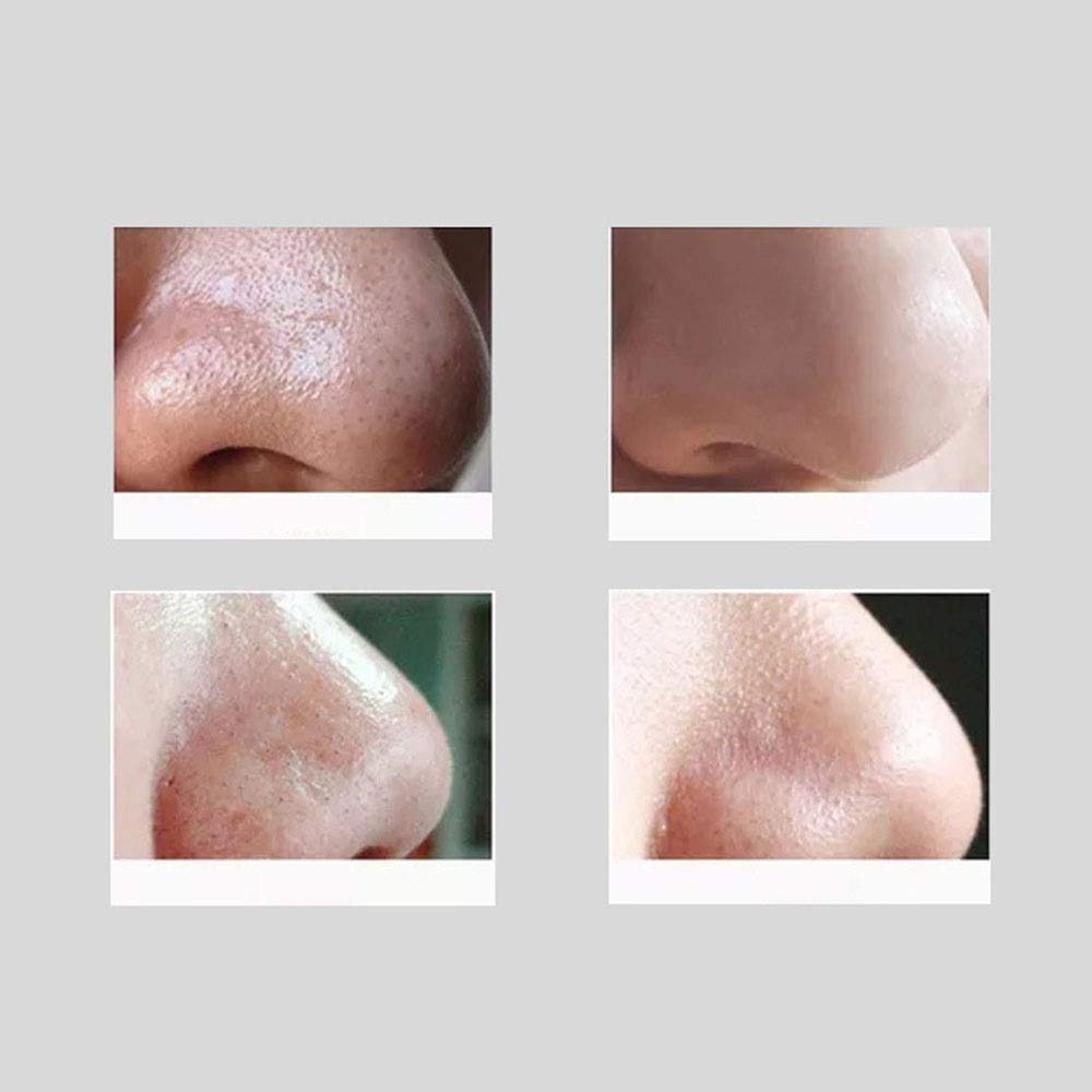 Removedor Blackhead Vacuum Electric BlackheadRemoval Herramientas de Limpiador de Poros Limpiador Facial Limpiador Facial SuctionTools con LED, 7Probóviles de reemplazo, USB Recargable