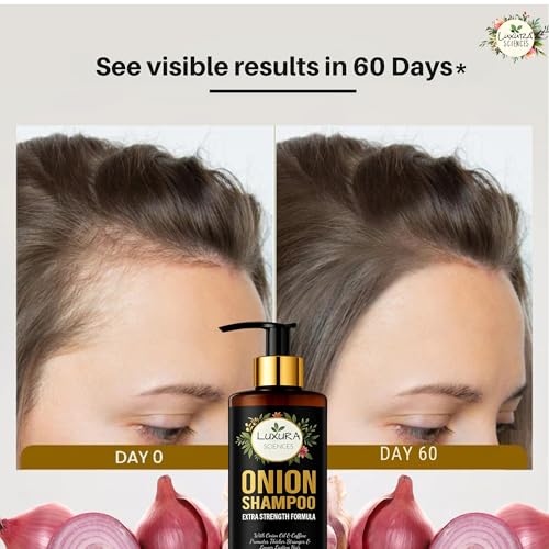 Image of Luxura Sciences Onion Oil Shampoo For Hair Growth 300 ML, Sulphate Free Shampoo (NO Parabens,Silicones or Colorants)