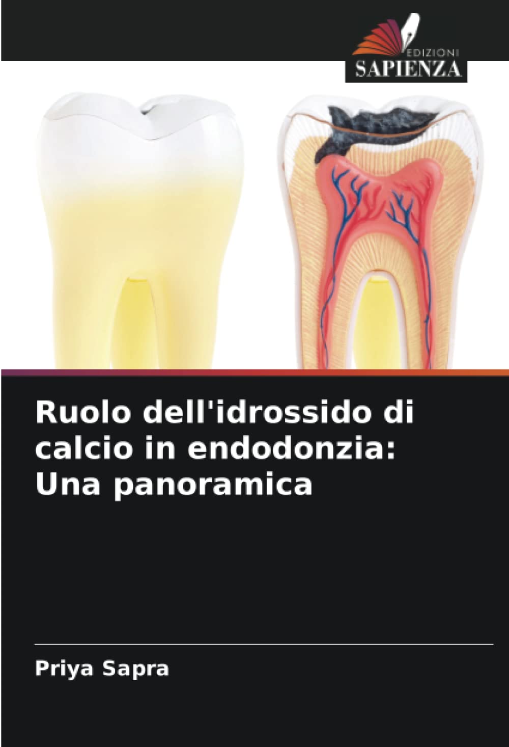 Ruolo dell'idrossido di calcio in endodonzia: Una panoramica