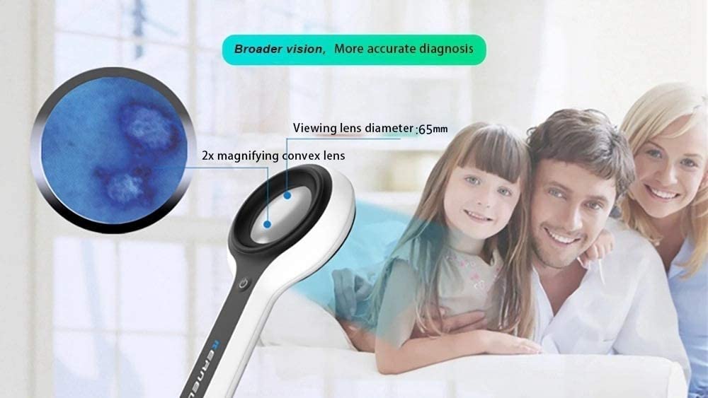 Luces quirúrgicas examen Lámpara Fluorescente De 65 Mm, Lámpara De Aumento For Examen, Analizador De Piel Dermatológico, Luz Negra UV Portátil De 365 Nm
