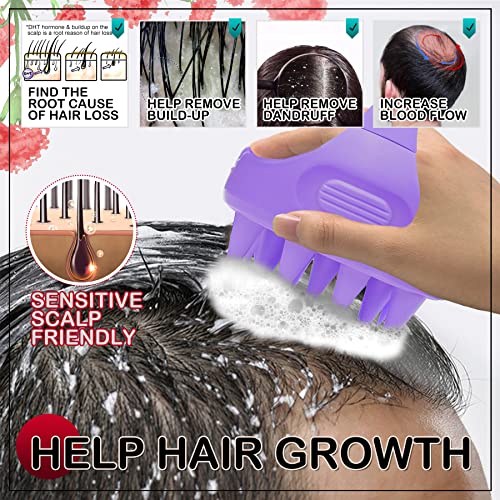 Scalp Massager Shampoo Brush, 2 Pack Scalp Brush For Hair Growth, Soft Silicone Scalp Exfoliator For Dandruff Removal, Scalp Care Scrubber For All Hair Types Of Girls, Teens, Kids, Men, Pet Dogs #TOP3