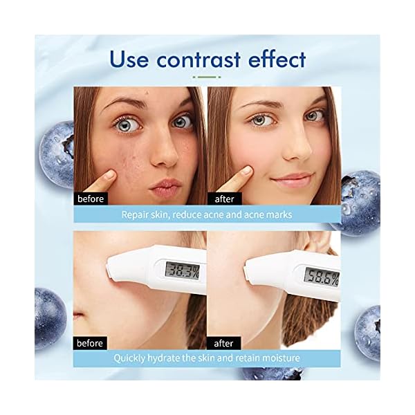 Dead-Sea-Mud-Mask-for-Face-Clay-Mask-Skincare-Blueberry-Vitamin-C-Clay-Mask-Purifying-Clay-Mask-Green-Tea-Natual-Bentonite-Healing-Clay-Mask-Blackhead-Remover-Deep-Cleansing-Hydrating-Facial-Gift Dead Sea Mud Mask for Face Clay Mask Skincare Blueberry Vitamin C Clay Mask Purifying Clay Mask Green Tea Natual Bentonite Healing Clay Mask Blackhead Remover Deep Cleansing Hydrating Facial Gift