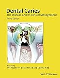 Dental Caries: The Disease and its Clinical Management by Ole Fejerskov (Editor), Bente Nyvad (Editor), Edwina Kidd (Editor) (8-May-2015) Hardcover