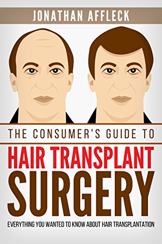 The Consumer’s Guide to Hair Transplant Surgery: Everything You Wanted To Know About Hair Transplantation (English Edition) - Affleck, Jonathan