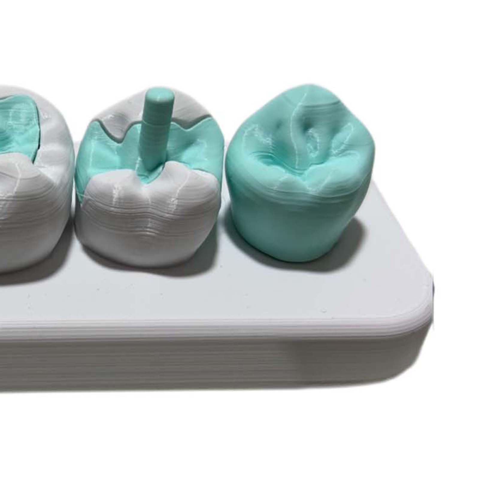 Modello di Intarsio e Onlay, Modello Didattico di Corona Completa con Attacco Magnetico, per la Comunicazione Dentista-Paziente