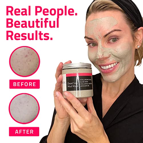 Yeouth Dead Sea Mud Mask With Hyaluronic Acid, Face Masks Skincare Mud For Pore, Wrinkles, Acne & Dark Spots, Anti Aging Facial & Beauty Face Masks #TOP5