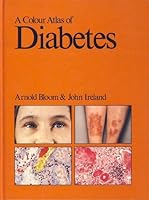 Color Atlas Of Diabetes 0723407207 Book Cover