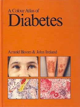 Hardcover A Colour Atlas of Diabetes by Arnold Bloom and John Ireland [Unqualified] Book