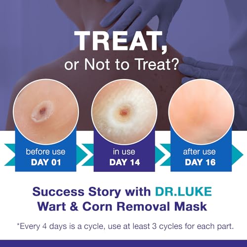 image for Dr. Luke Strongest Wart Corn Remover Mask For Toes Fingers: Foot Wart 