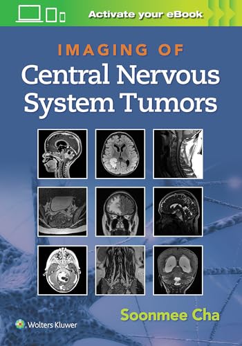 Compare Textbook Prices for Imaging of Central Nervous System Tumors First Edition Edition ISBN 9781975103743 by Cha, Dr. Soonme