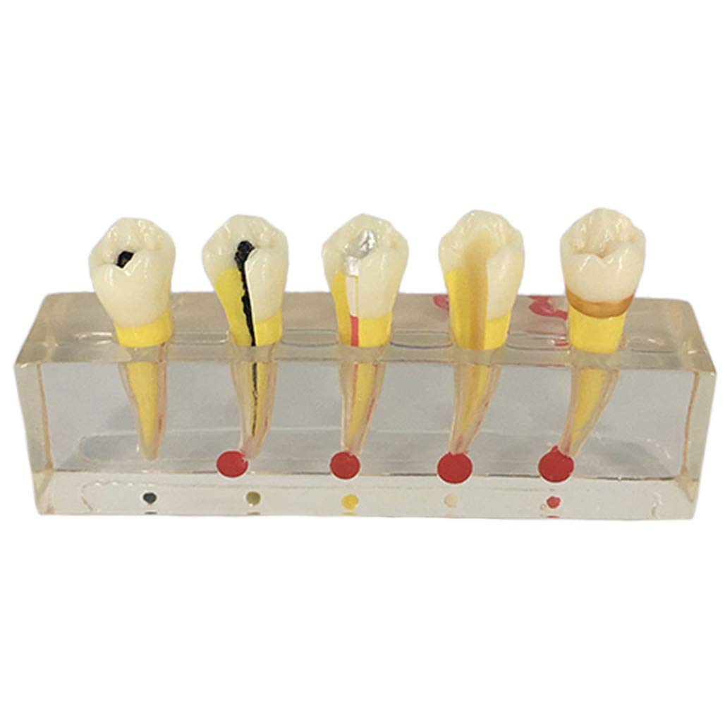 Dentiste de Formation modèle d'enseignement à communiquer avec Les Patients modèle Dentaire modèle Dentaire de la résine de démonstration Dentaire