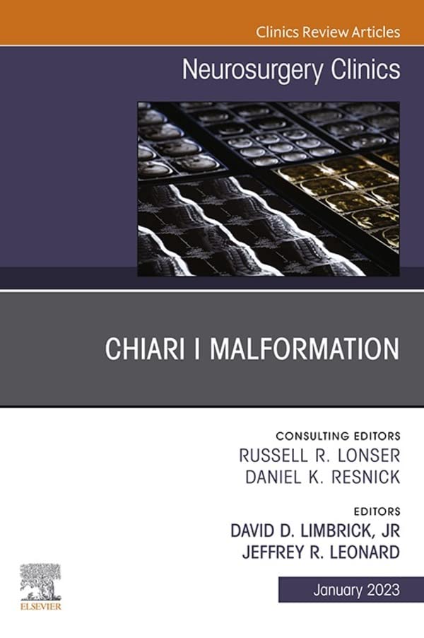 Chiari Malformation in Children: What Parents Need to Know Chiari Malformation in Children: What Parents Need to Know