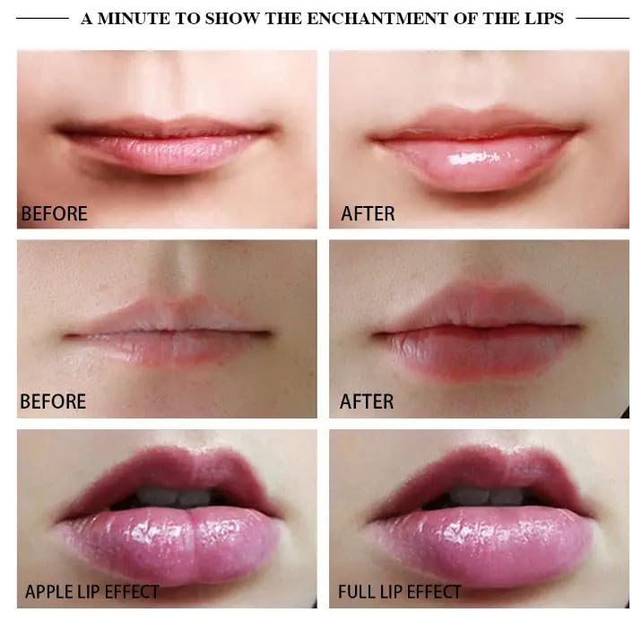 SEMINO Automatic Electric Lip Plumper Enhancement Device Safe & Effective Lip Plumping Solution Vacuum Vibrating Lips Device - Image 3