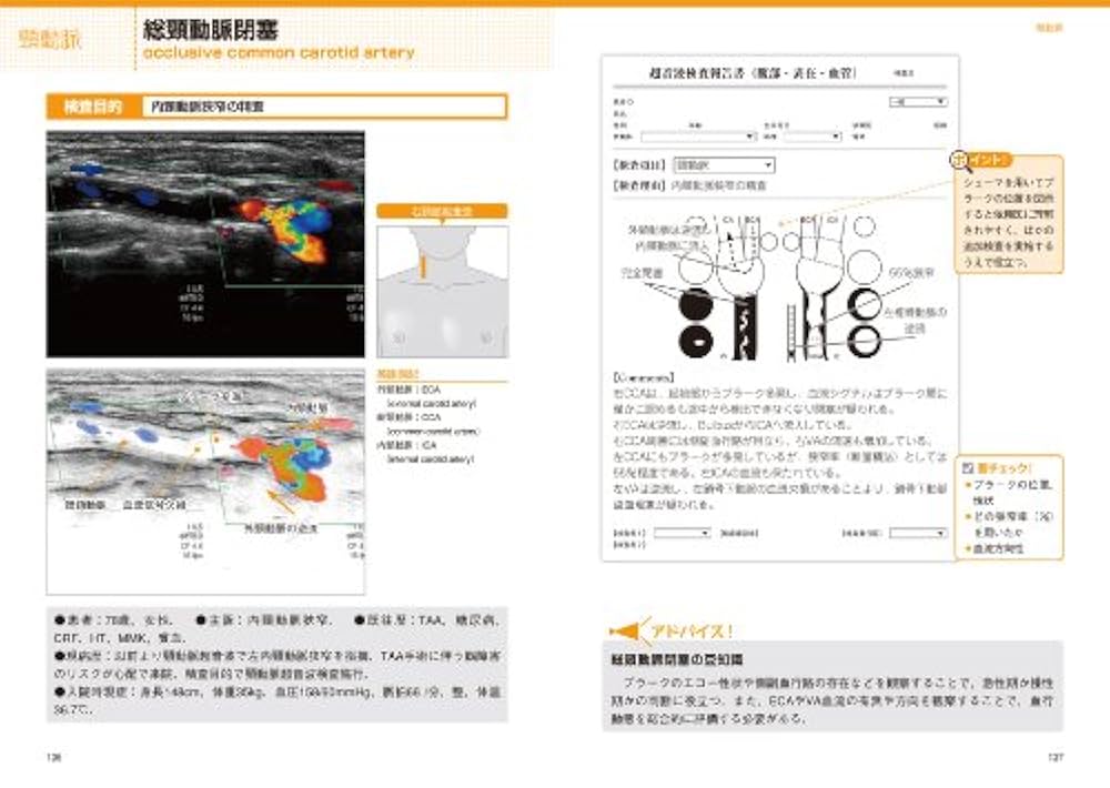 超音波検査報告書の書き方 : 「おっ」と思わせる! 心臓/血管 超音波検査報告書の書き方【心臓/血管】 (「おっ」と思わせる