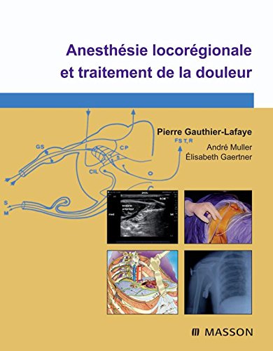 Anesthésie locorégionale et traitement de la douleur (Ancien Prix éditeur : 125 euros)