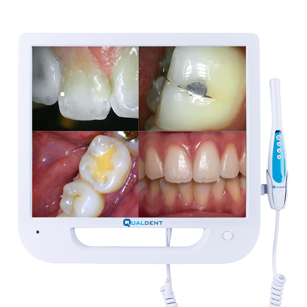 Qualdent Intraoral Camera with 17-inch HD Screen – 10 MP Dental Camera, CMOS Sensor, 6 High-Intensity LED Lights, Auto Focus 5-50mm, 256GB Storage