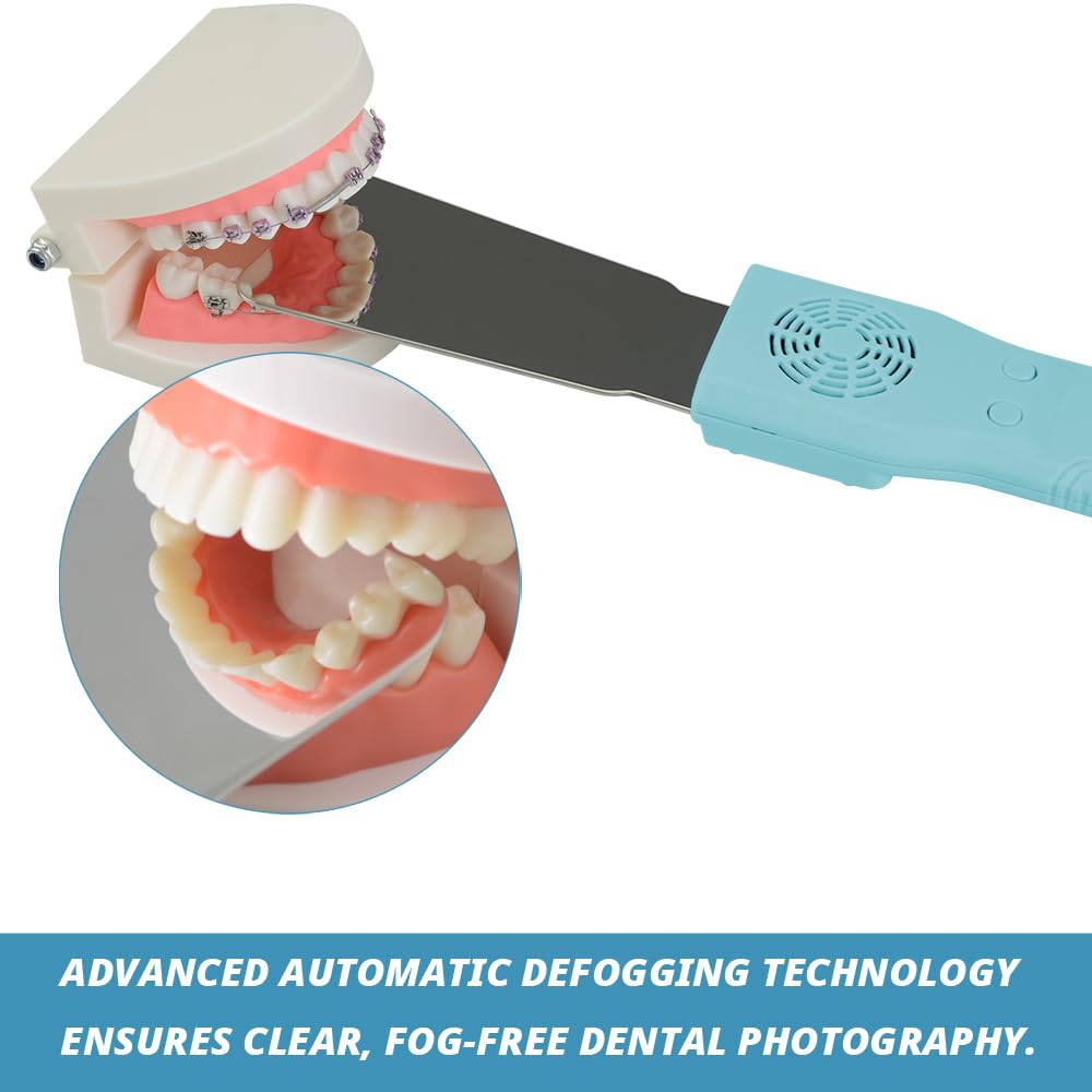 AZDENT LED Dental Mirror – Auto Anti-Fog – Oral Photography Reflector – 116006040
