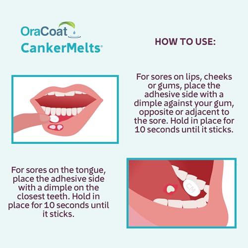 Image of Oracoat CankerMelts Stick-On Melts Canker Sore Treatment for Mouth Sores with 15mg Benzocaine, Hyaluronic Acid & Vitamin E