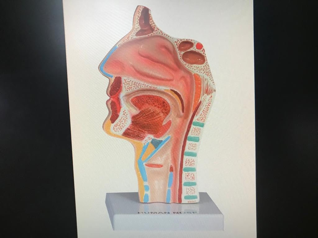 See full amazon price history chart for E-MEDI- Human Larynx and Pharynx Disorders Model Comes on White Base E-MEDI- Human Larynx and Pharynx Disorders Model Comes on White Base (B0D1YBPXJ2) Amazon Price History, Amazon Price Tracker