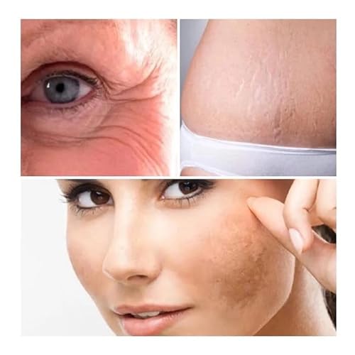 Dermcos Oleo Corporal Rosa Mosqueta Puro Clareador De Manchas No Rosto E Corpo 30 Ml