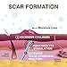Epiderm Areopexy Clear Silicone Scar Sheets - Reusable, Washable & Customizable - “Lollipop” Shape Ideal for Lejour Breast Augmentation - Made from Premium-Grade Silicone for Optimal Scar Management