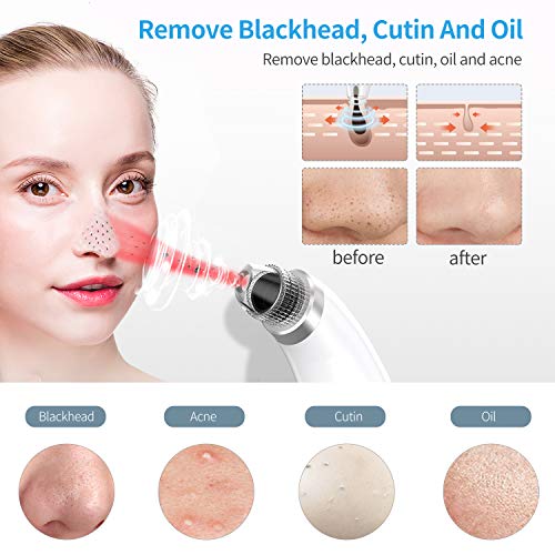 Blackhead Remover Vacuum Facial Pore Cleanser, Electric Acne Nose Comedone Suction Tool, HOKLAN USB Rechargeable Blackhead Exactor Removal Tool for Women Men with 45℃ Hot Compress & LED Display