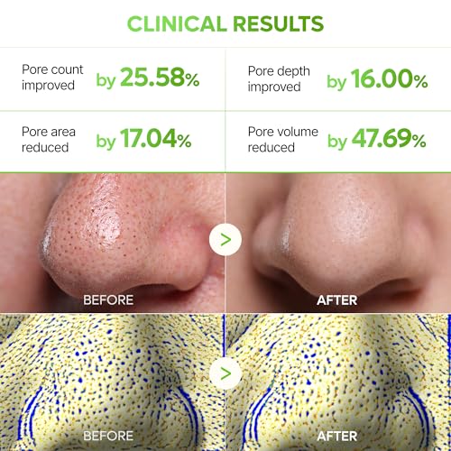 Dr.Melaxin CACTOX 3-STEP NOSE MASK PACK with AHA & PHA for Sebum Softening Pore Tightening Skin Repair 3-Step Nose Pore Pack - Image 5