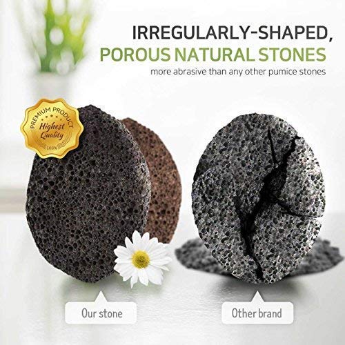 100% Pumice Stone For Feet Exfoliation To Remove Dead Skin #TOP1