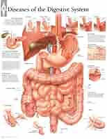 Diseases of Digestive System chart: Laminated Wall Chart