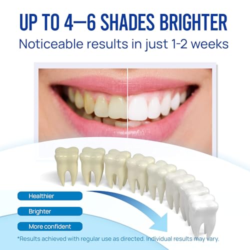 teeth whitening pen gel kit 35 carbamide peroxide gel for stain removal - no sensitivity with remineralizing pen for a brighter whiter smile mint 5 pack