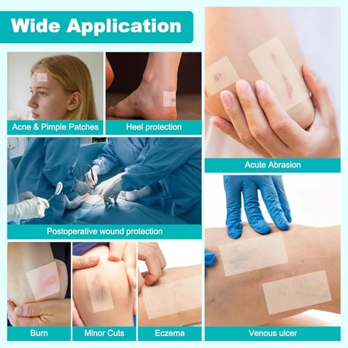 Image of Hydrocolloid Roll for Wound Care, Hydrocolloid Bandages with Self-Adhesive, Cut-to-Size Patch Bandages, Ultra Absorbent, Waterproof, First Aid Kit Essential (2IN*12FT)