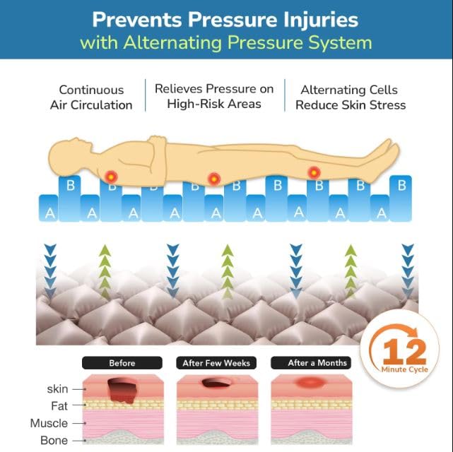 Image of TenTabs Anti Bedsore Air Mattress with Pump for Bedridden Patients | Alternating Pressure Air Mattress | Medical Air Bed for Patients, Elderly & Home Care | Hospital Bed Mattress