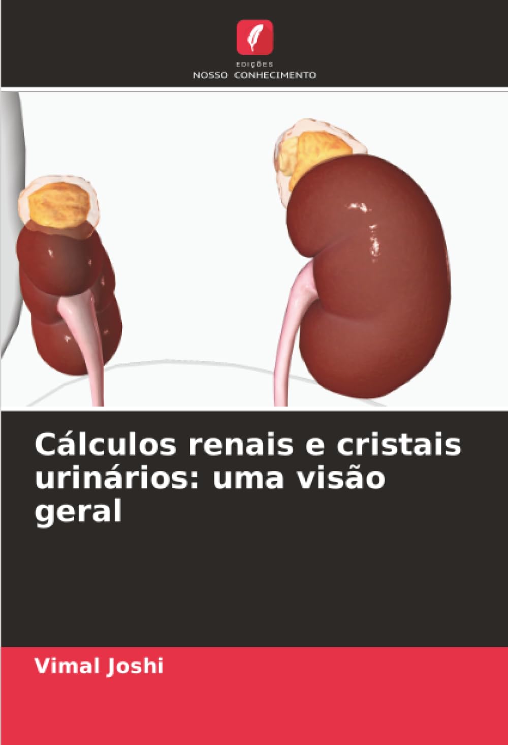 Cálculos renais e cristais urinários: uma visão geral