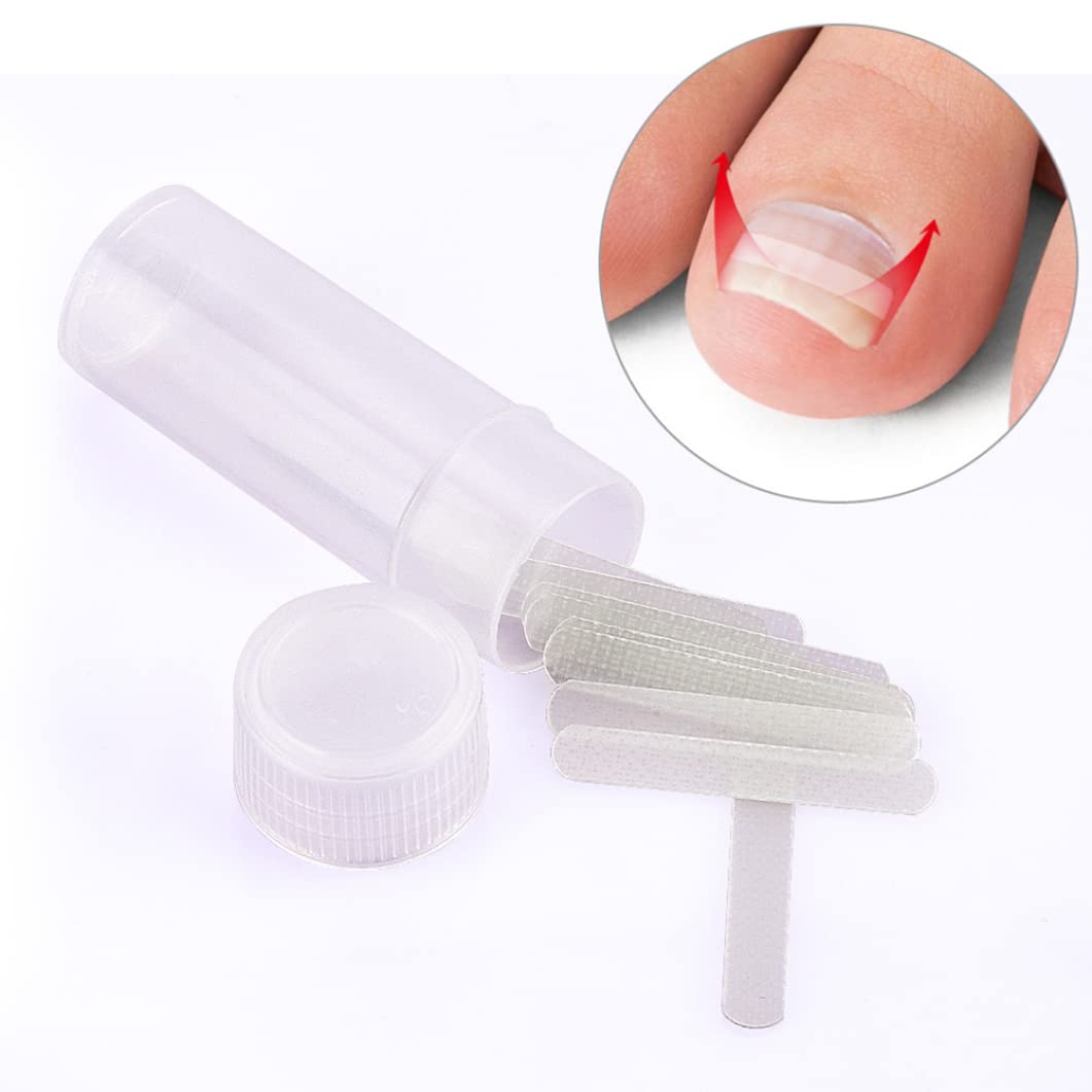 Kit di correzione della patch di unghie dei piedi incarniti elastico patch per chiodi con glu -correzione della file unghie