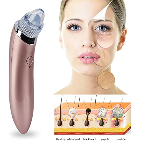 GPCT Electric Facial Pore Cleaner Blackhead Vacuum Suction Remover Cover