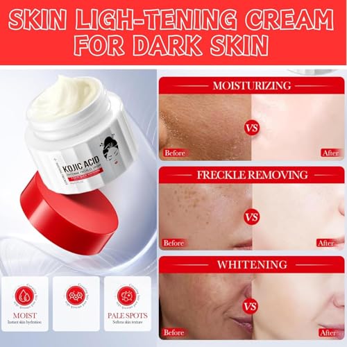 Generic Kojic Acid Cream – Dark Spot Remover for Face and Body, Skin Brightening Cream for Age Spots, Kojic Acid Lotion for All Skin Types