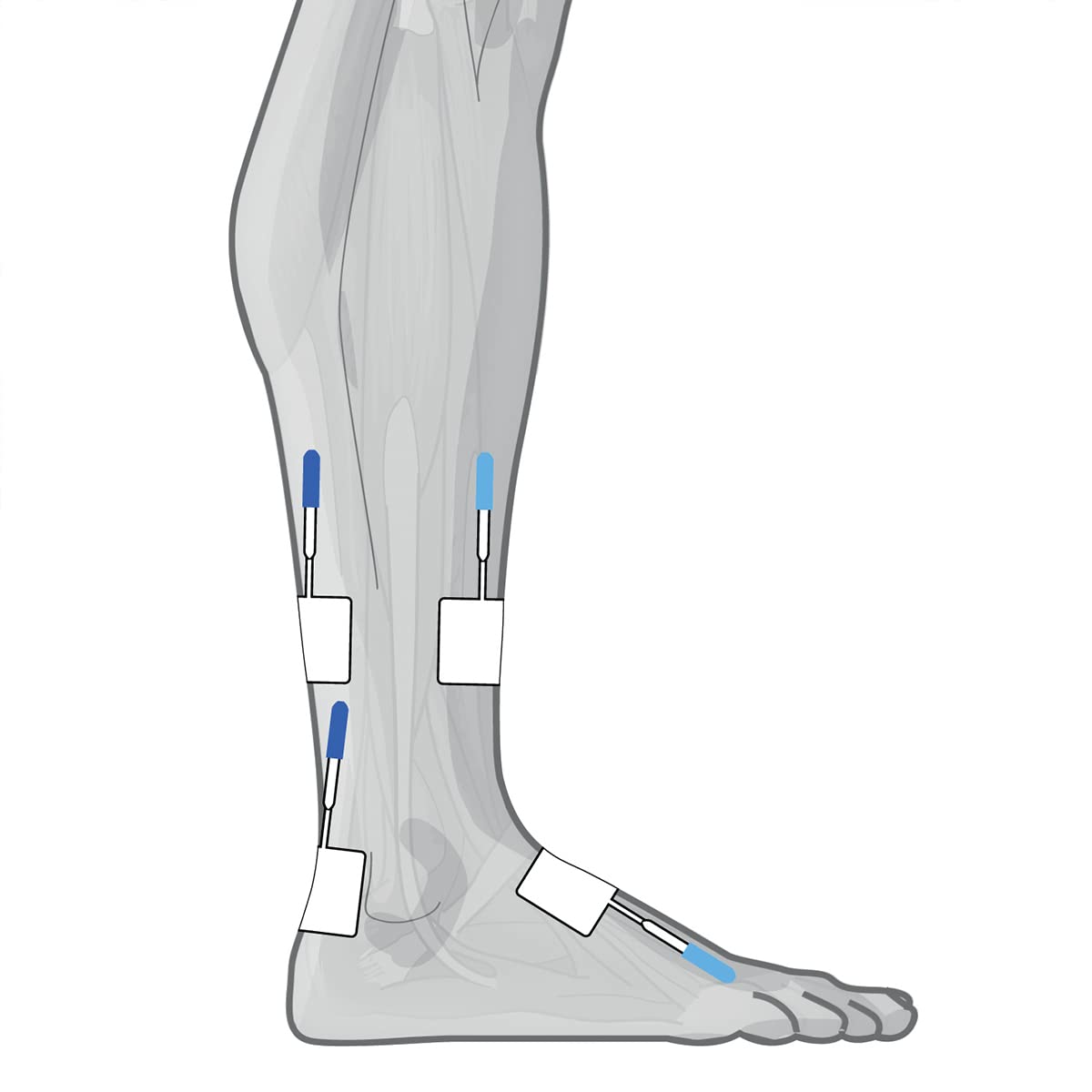 GLOBUS | Genesy 300 PRO, Elettrostimolatore a 4 Canali, 91 Programmi per La Fisioterapia