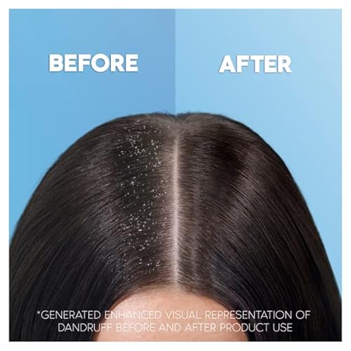 Head & Shoulders Classic Clean Anti-Dandruff 2-in-1 Shampoo and conditioner